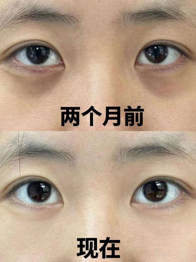 管眼霜效果、肤感一流的眼霜解析凯发国际广受好评的初源漾小绿