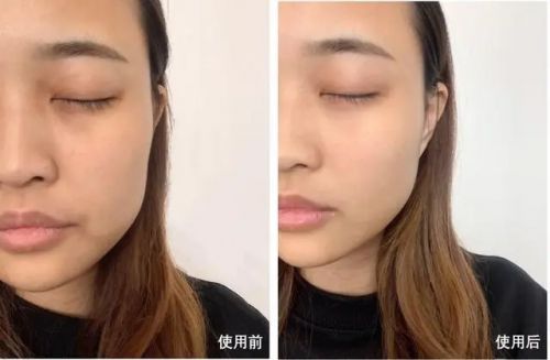抗皱好？让肌肤焕发新生k8凯发全站哪种护肤品