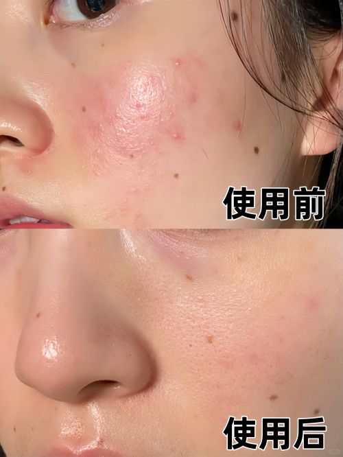 大适合追求年轻肌肤的人K8凯发国际抗皱面霜十(图3)